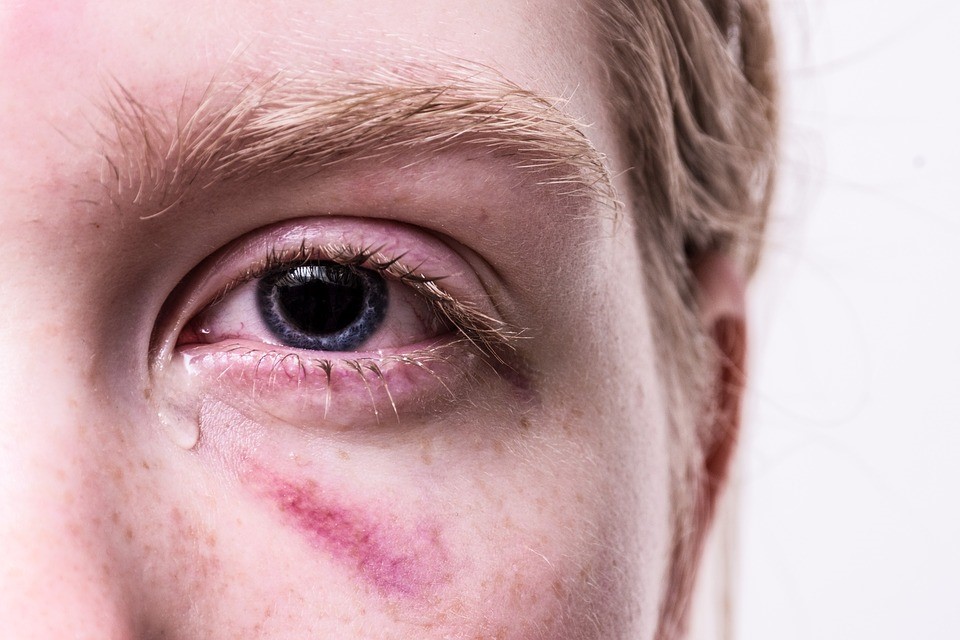 Nevada Domestic Violence Laws - Attorney Ross Goodman