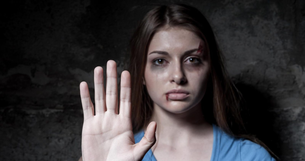 DUI Causing Substantial Bodily Harm