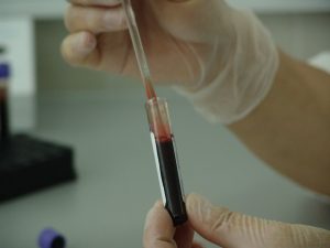 DUI blood tests factors--featured image